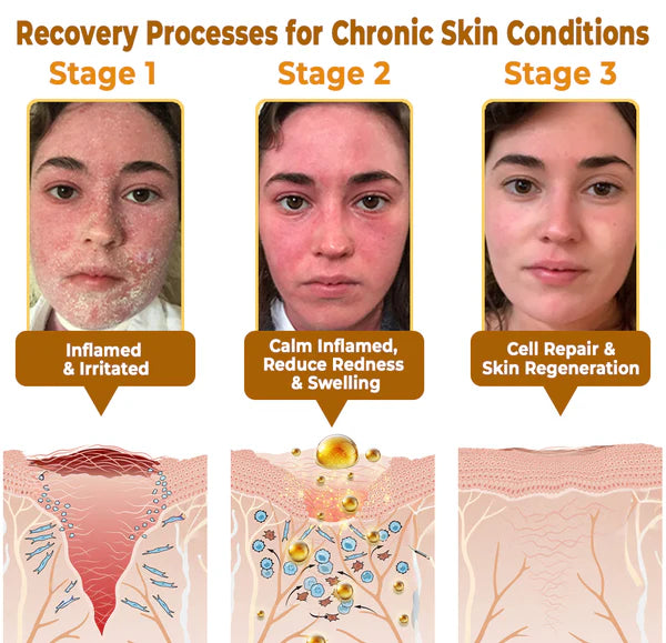 BeeRx™ Bee Venom Skin Restoration Cream 21 gempages 558182816613926131 51b5c2db 9fb1 46f3 9267 680fe58897d2