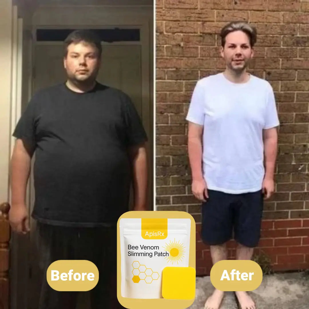 ApisRx Bee Venom Slimming Patch