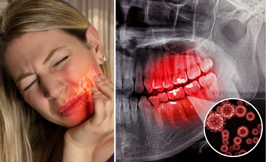 BelleDente revitalizes gums 8 1748572541 3