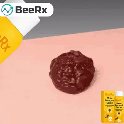 BeeRx Mole Removal Spray 23 1741059433 bss1 ezgif.com gif to webp converter