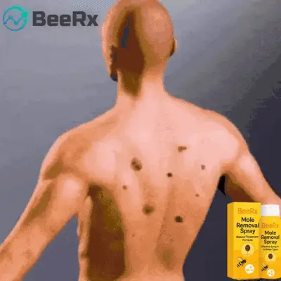 BeeRx Mole Removal Spray 24 1741059440 bss2 ezgif.com gif to webp converter